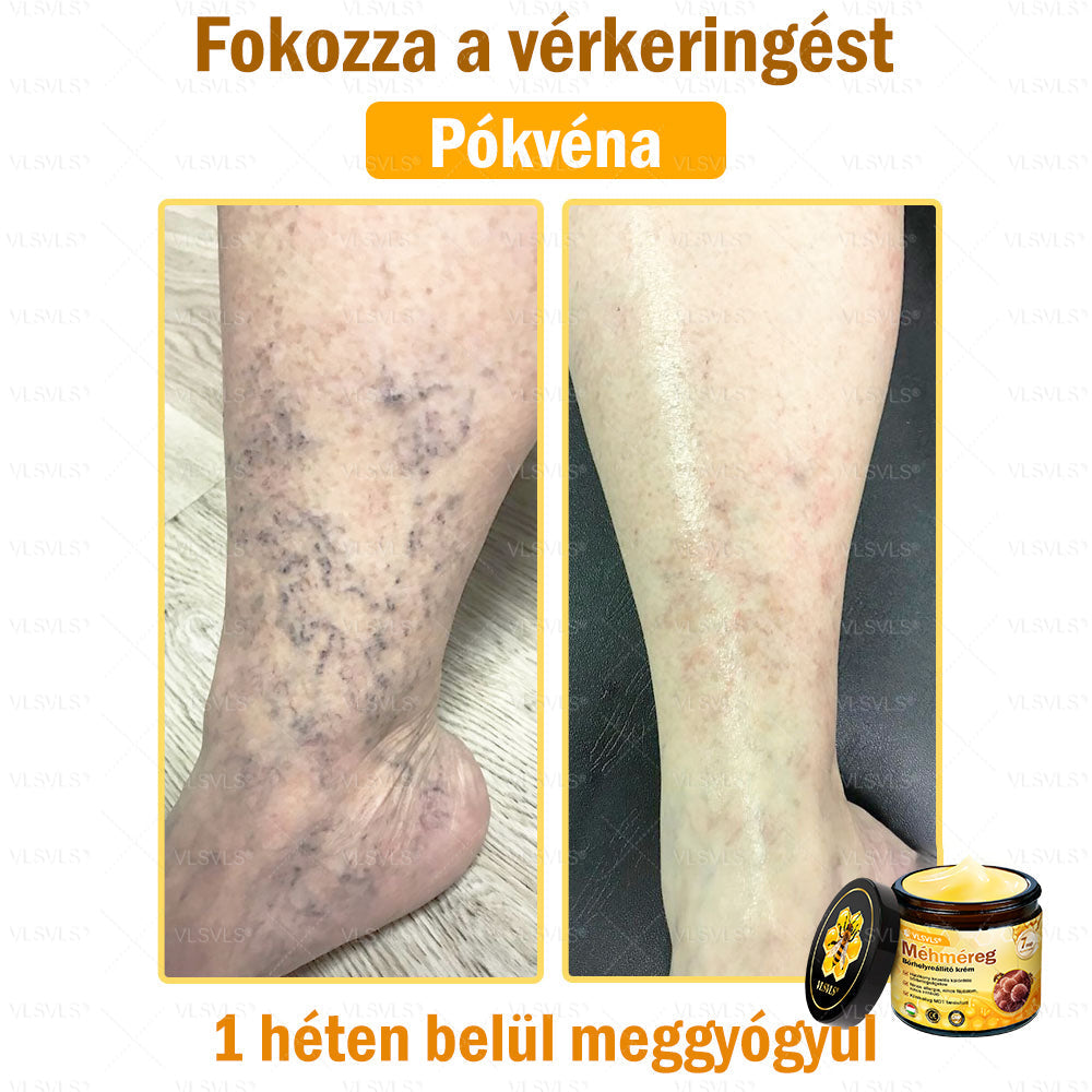 💪VLSVLS® Méhméreg Bőrhelyreállító Krém (👨⚕CE jóváhagyott)👍✅