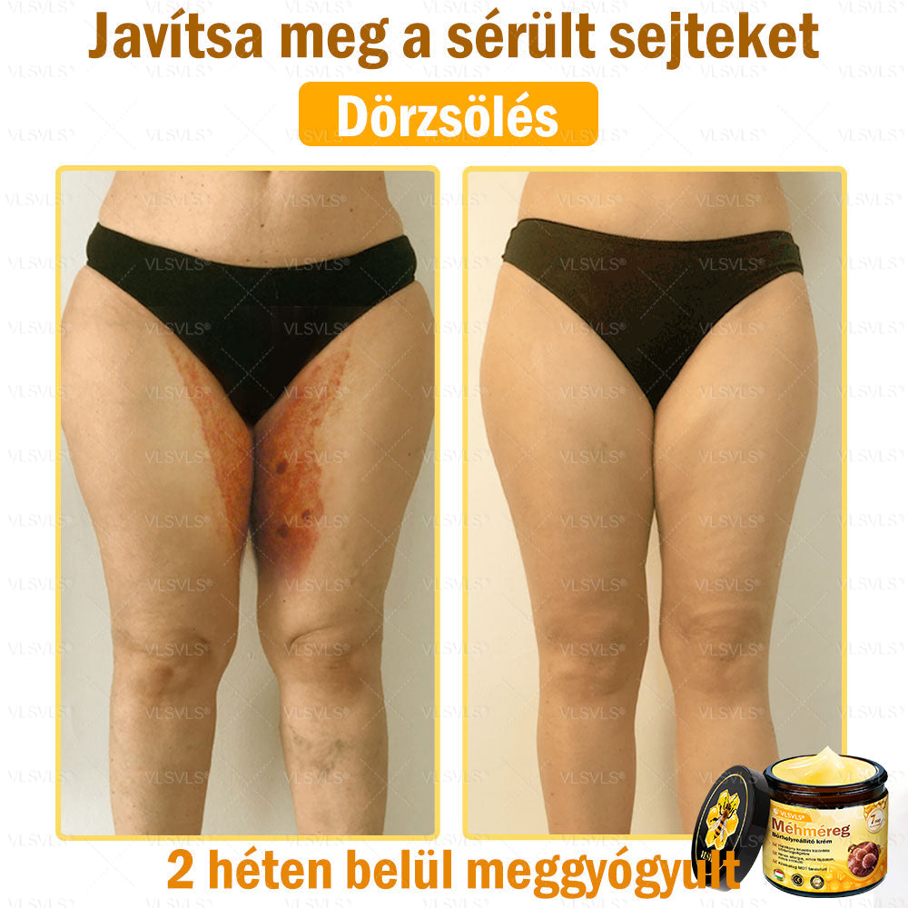 💪VLSVLS® Méhméreg Bőrhelyreállító Krém (👨⚕CE jóváhagyott)👍✅