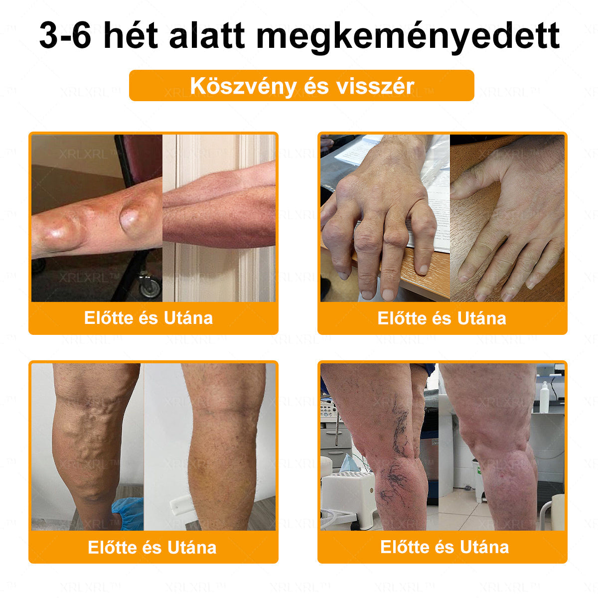 👍👍👍XRLXRL™ Méhméreg Fájdalomcsillapító Csontregeneráló Krém (Speziell für ältere Erwachsene & von der AAOS empfohlen)