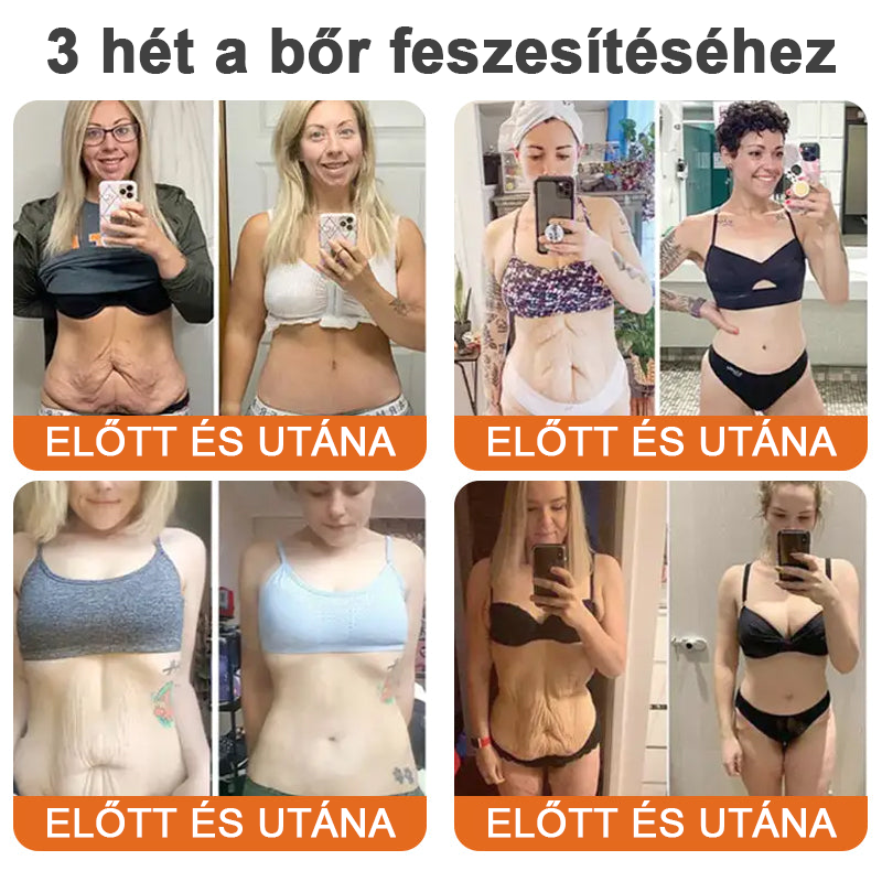 Az USA-ból készült és szállították✨Turonu™ Botox Bee Venom bőrfeszesítő szérumstick (🔥Utolsó NAP 70% KEDVEZMÉNY)💄
