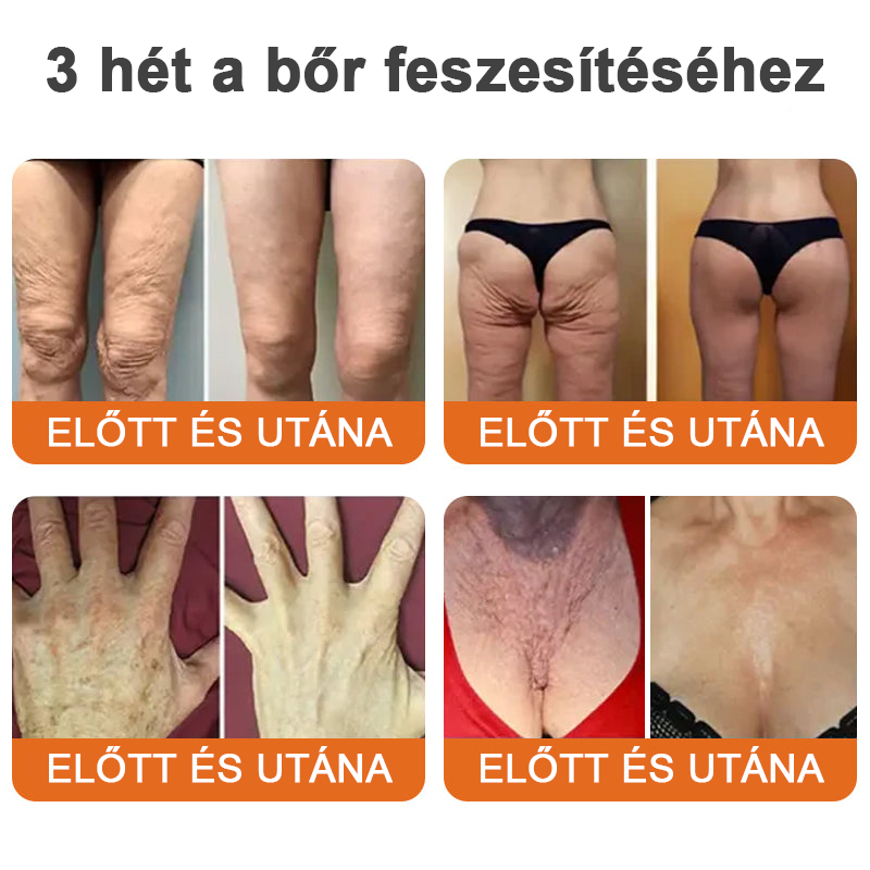 Az USA-ból készült és szállították✨Turonu™ Botox Bee Venom bőrfeszesítő szérumstick (🔥Utolsó NAP 70% KEDVEZMÉNY)💄