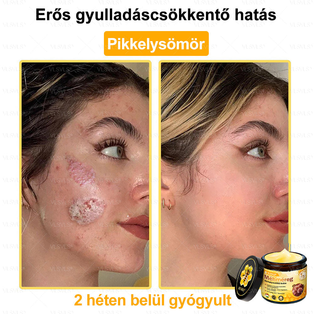 💪VLSVLS® Méhméreg Bőrhelyreállító Krém (👨⚕CE jóváhagyott)👍✅