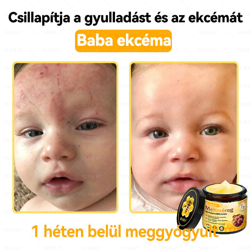 💪VLSVLS® Méhméreg Bőrhelyreállító Krém (👨⚕CE jóváhagyott)👍✅