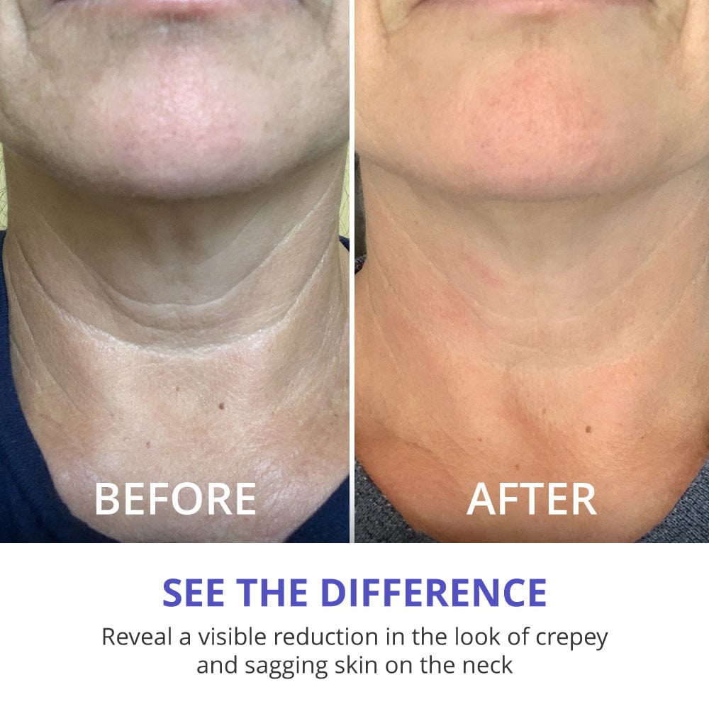 GOPURE Tighten & Lift Neck Cream