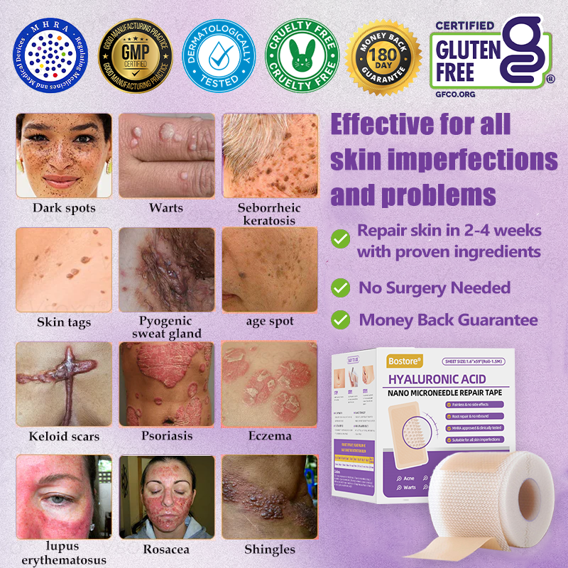 A bőr bizalmának kezdete itt van ✅ Bosstore® Hialuronsav Nano Mikrotűs Javító Tapasz ✴️ Különféle hegekre, striákra, foltokra, keloidokra, keratózisra, aknéra, égési sérülésekre, szemölcsökre, bőrcímkékre és visszértágulatokra.