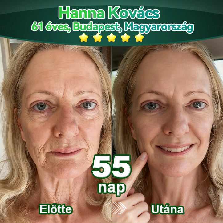 𝑳𝒐𝒕𝑚𝑎𝑦® Ő𝑠𝑠𝑒𝑗𝑡 & 𝐾𝑜𝑙𝑙𝑎𝑔é𝑛 𝑷𝒆𝒑𝒕𝒊𝒅 𝑶𝒓á𝒍𝒊𝒔 𝑪𝒔𝒆𝒑𝒑𝒆𝒌 💧(𝑭𝒆𝒔𝒛𝒆𝒔í𝒕𝒊 𝒂 𝒎𝒆𝒈𝒆𝒓𝒆𝒔𝒛𝒌𝒆𝒅𝒆𝒕𝒕 𝒃ő𝒓𝒕 & 𝑪𝒔ö𝒌𝒌𝒆𝒏𝒕𝒊 𝒂 𝒓á𝒏𝒄𝒌é𝒑𝒛ő𝒅é𝒔𝒕)👍