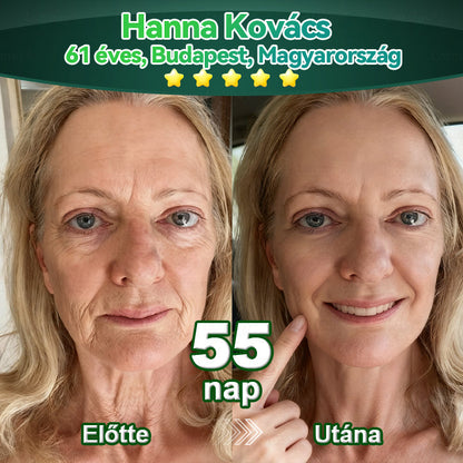 𝑳𝒐𝒕𝑚𝑎𝑦® Ő𝑠𝑠𝑒𝑗𝑡 & 𝐾𝑜𝑙𝑙𝑎𝑔é𝑛 𝑷𝒆𝒑𝒕𝒊𝒅 𝑶𝒓á𝒍𝒊𝒔 𝑪𝒔𝒆𝒑𝒑𝒆𝒌 💧(𝑭𝒆𝒔𝒛𝒆𝒔í𝒕𝒊 𝒂 𝒎𝒆𝒈𝒆𝒓𝒆𝒔𝒛𝒌𝒆𝒅𝒆𝒕𝒕 𝒃ő𝒓𝒕 & 𝑪𝒔ö𝒌𝒌𝒆𝒏𝒕𝒊 𝒂 𝒓á𝒏𝒄𝒌é𝒑𝒛ő𝒅é𝒔𝒕)👍