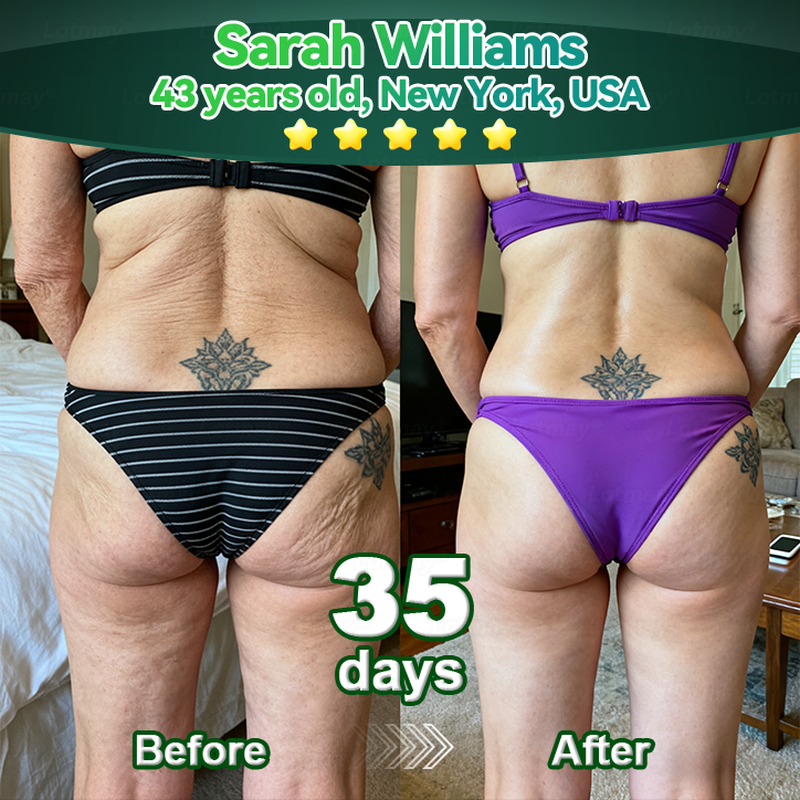 Lotmay® 🚀 Őssejt & Kollagén Peptid Orális Cseppek