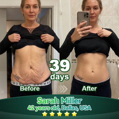 Lotmay® 🚀 Őssejt & Kollagén Peptid Orális Cseppek