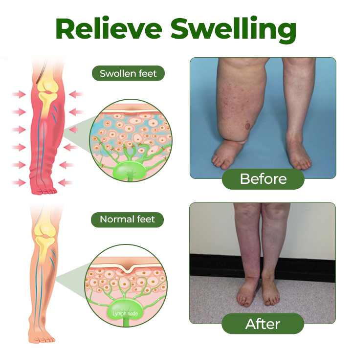 Timilk® Professional lábkeringést serkentő krém