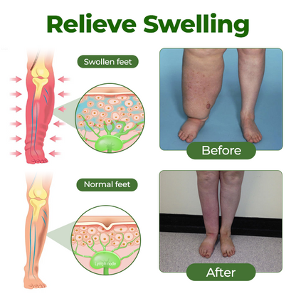 Timilk® Professional lábkeringést serkentő krém