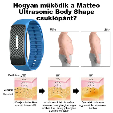 🥑 𝐉𝐎𝐒𝐅𝑰𝐓™ Ultrahangos csuklópántok a zsír eltávolítására és méregtelenítésére