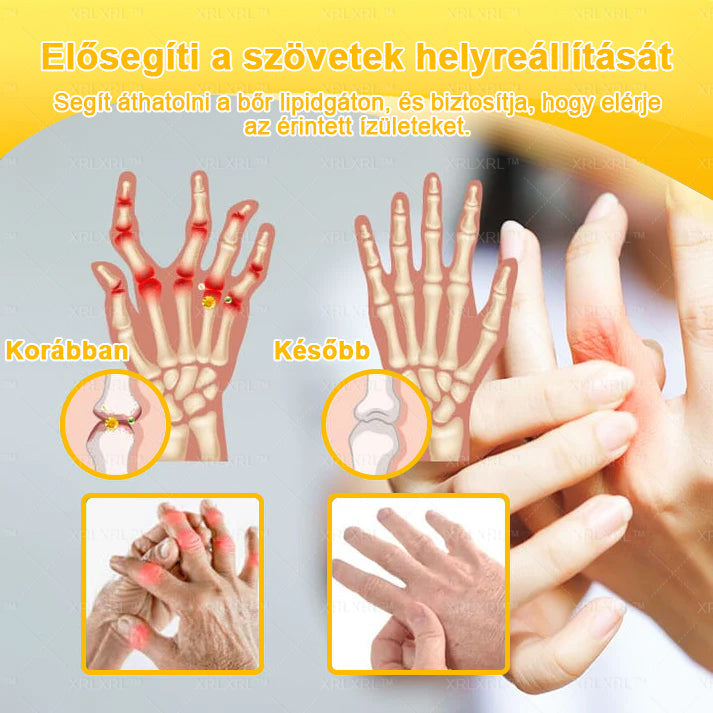 👍👍👍XRLXRL™ Méhméreg Fájdalomcsillapító Csontregeneráló Krém (Speziell für ältere Erwachsene & von der AAOS empfohlen)