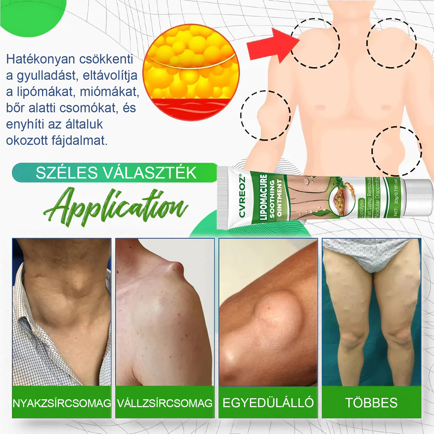 Cvreoz® Lipoma Cure nyugtató kenőcs