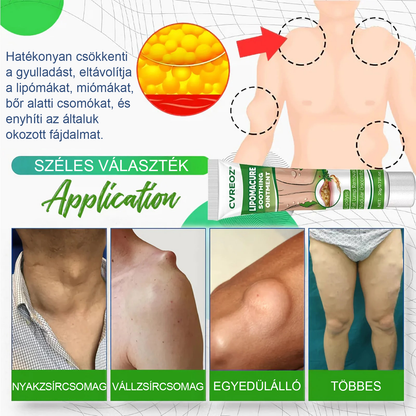 Cvreoz® Lipoma Cure nyugtató kenőcs
