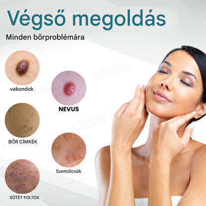 Bikenda® non-invazív anyajegy- és szemölcseltávolító lézertoll