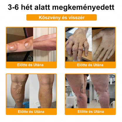 👍👍👍XRLXRL™ Méhméreg Fájdalomcsillapító Csontregeneráló Krém (Speziell für ältere Erwachsene & von der AAOS empfohlen)