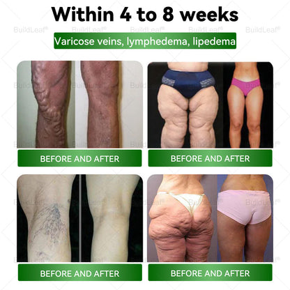 A Mayo Klinika ajánlásával | Hivatalos áruház |💎𝐁𝐮𝐢𝐥𝐝𝐋𝐞𝐚𝐟® Tirzepatide GLP-1 Moringa Fogyókúrás és Egészségfokozó Cseppek (Élelmiszeripari minőségű zsírégető - Az Elhízás Társaság fejlesztette ki)
