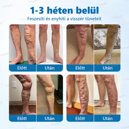 💚💚Trimil® VeinGuard Gyógynövényes Spray - ✅ Klinikailag bizonyított, hogy mindössze 7 nap alatt megszünteti a visszereket!