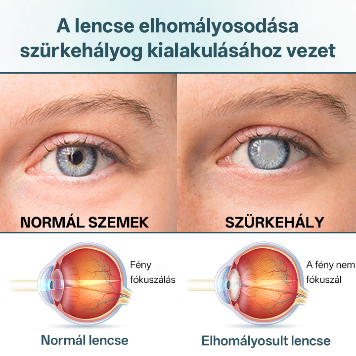 Timilk® OptiFusion Nano szemcsepp szérum🌟