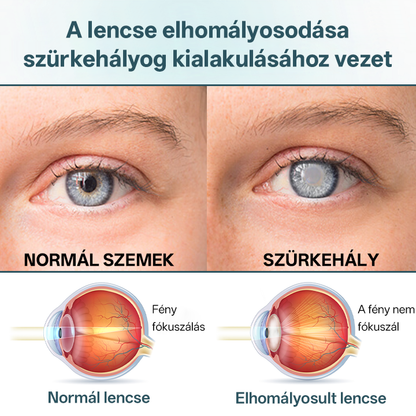 Timilk® OptiFusion Nano szemcsepp szérum🌟