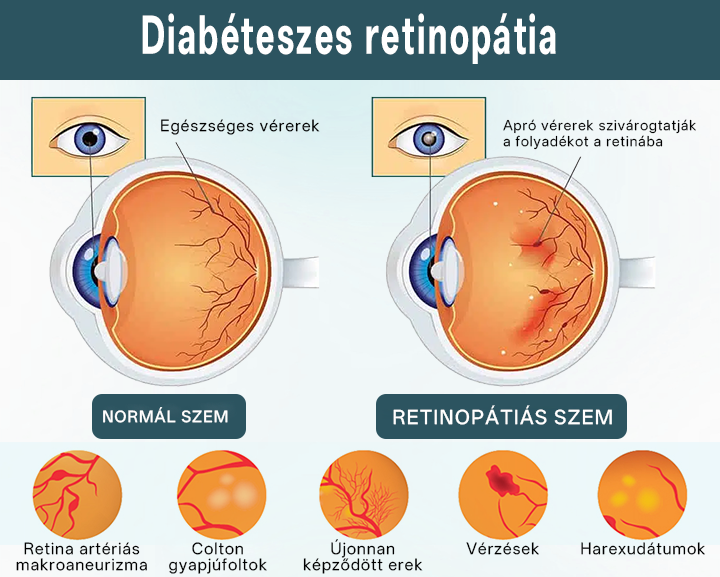 Timilk® OptiFusion Nano szemcsepp szérum🌟