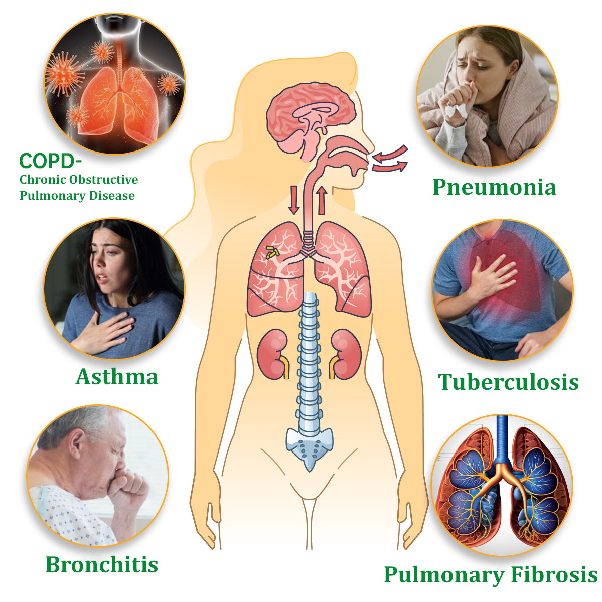 ✅Hivatalos üzlet: Ourlyard™ gyógynövényes tüdőtisztító inhalátor👨‍⚕️FDA-tanúsítvány (💝 Köhögés, sípoló légzés, légszomj, köpet, orrdugulás, hörghurut, hörghurut, allergiás tünetek, tüdő kellemetlen érzés💝)