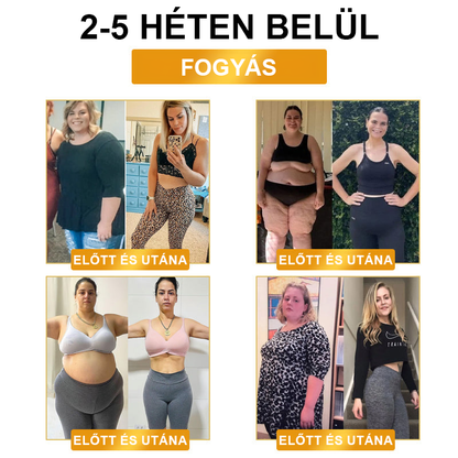 JOSFIT™ ultrahangos zsírfúvás és távoli infravörös vércukorszint-kiegyenlítő méregtelenítő csuklópánt - Energy Balance 🔥 Korlátozott idejű akció 🔥