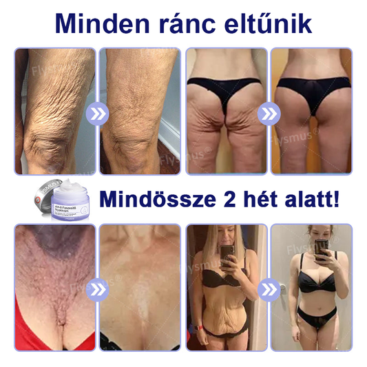 🌴🎁Ausztráliából készült és szállított - Flysmus® AH-8 Nyakfeszesítő és Lifting Krém - UTOLSÓ NAP 70% KEDVEZMÉNY