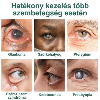 👩‍⚕️Ourlyard® Nano szemcsepp szérum ✅FDA által jóváhagyott (Alkalmas presbyopia, száraz szem szindróma, glaukóma és szürkehályog esetén) 👀