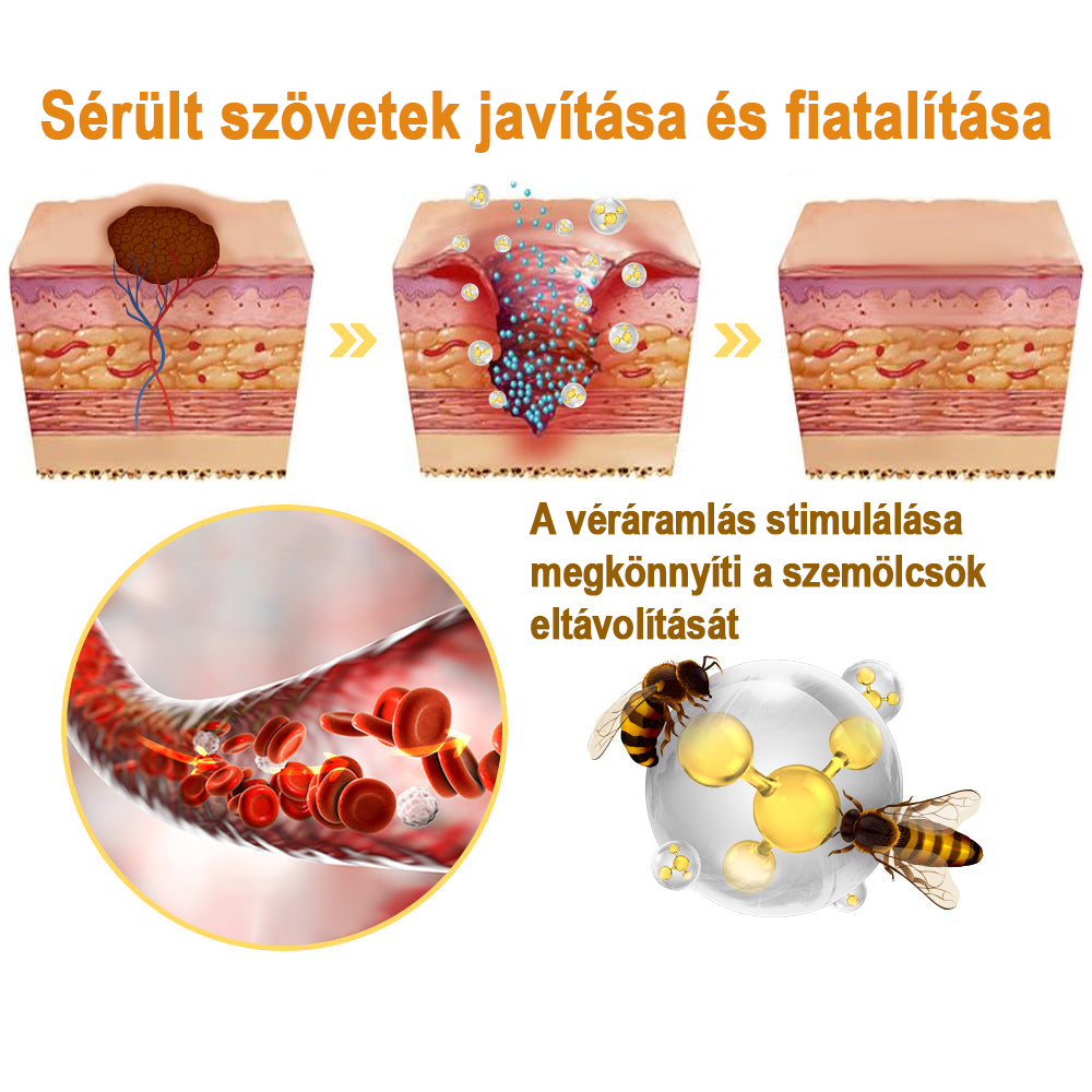 【💗utánvétel (COD)💗】Méhméreg szemölcs és övsömör eltávolító spray (👨‍⚕AAD Ajánlott) 🐝🐝🔥(🔥Last Day 80% Off)