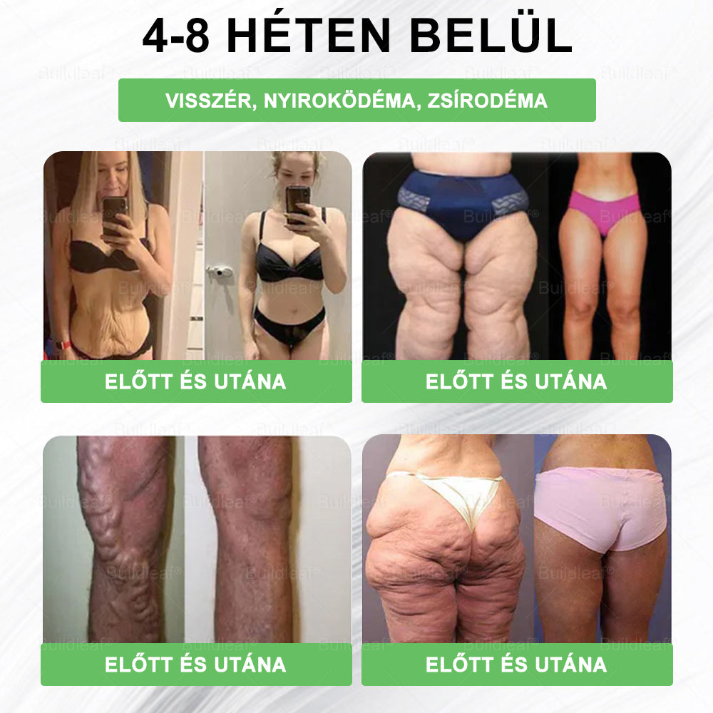 💚🍃 Klinikai kutatásokkal igazolt | A BuildLeaf® Berberine GLP-1 Pro Súlycsökkentő Szájon át szedhető oldat segíthet a makacs súlytöbblet, anyagcsere- és energiaproblémák kezelésében, támogatva a jobb közérzetet és vitalitást