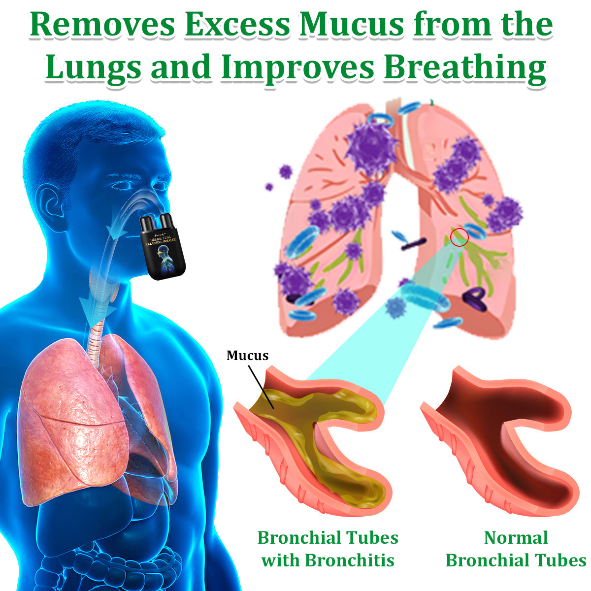 ✅Hivatalos üzlet: Ourlyard™ gyógynövényes tüdőtisztító inhalátor👨‍⚕️FDA-tanúsítvány (💝 Köhögés, sípoló légzés, légszomj, köpet, orrdugulás, hörghurut, hörghurut, allergiás tünetek, tüdő kellemetlen érzés💝)