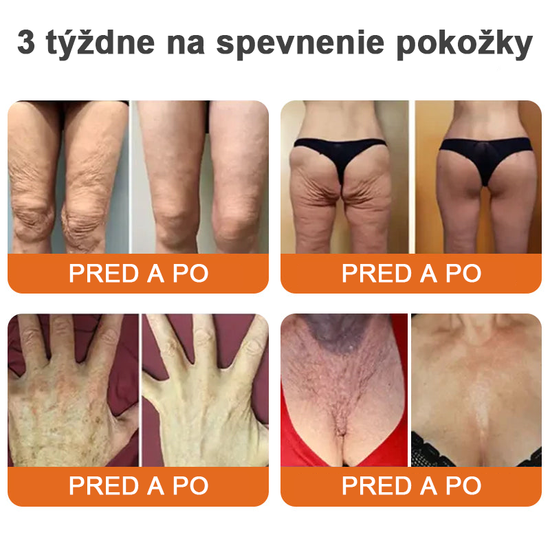 Vyrobené a dodané z USA ✨TLOPA® AH-8 Spevňujúci krém proti starnutiu (🔥 POSLEDNÝ DEŇ ZĽAVA 70 %)