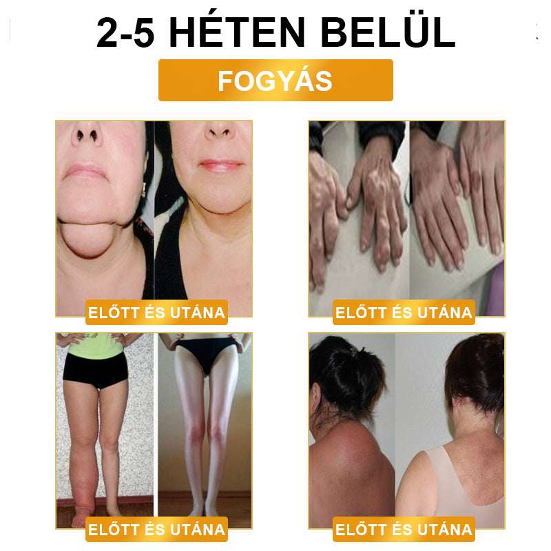 JOSFIT™ ultrahangos zsírfúvás és távoli infravörös vércukorszint-kiegyenlítő méregtelenítő csuklópánt - Energy Balance 🔥 Korlátozott idejű akció 🔥