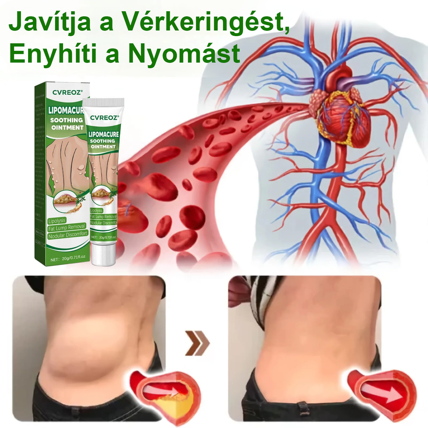 Cvreoz® Lipoma Cure nyugtató kenőcs