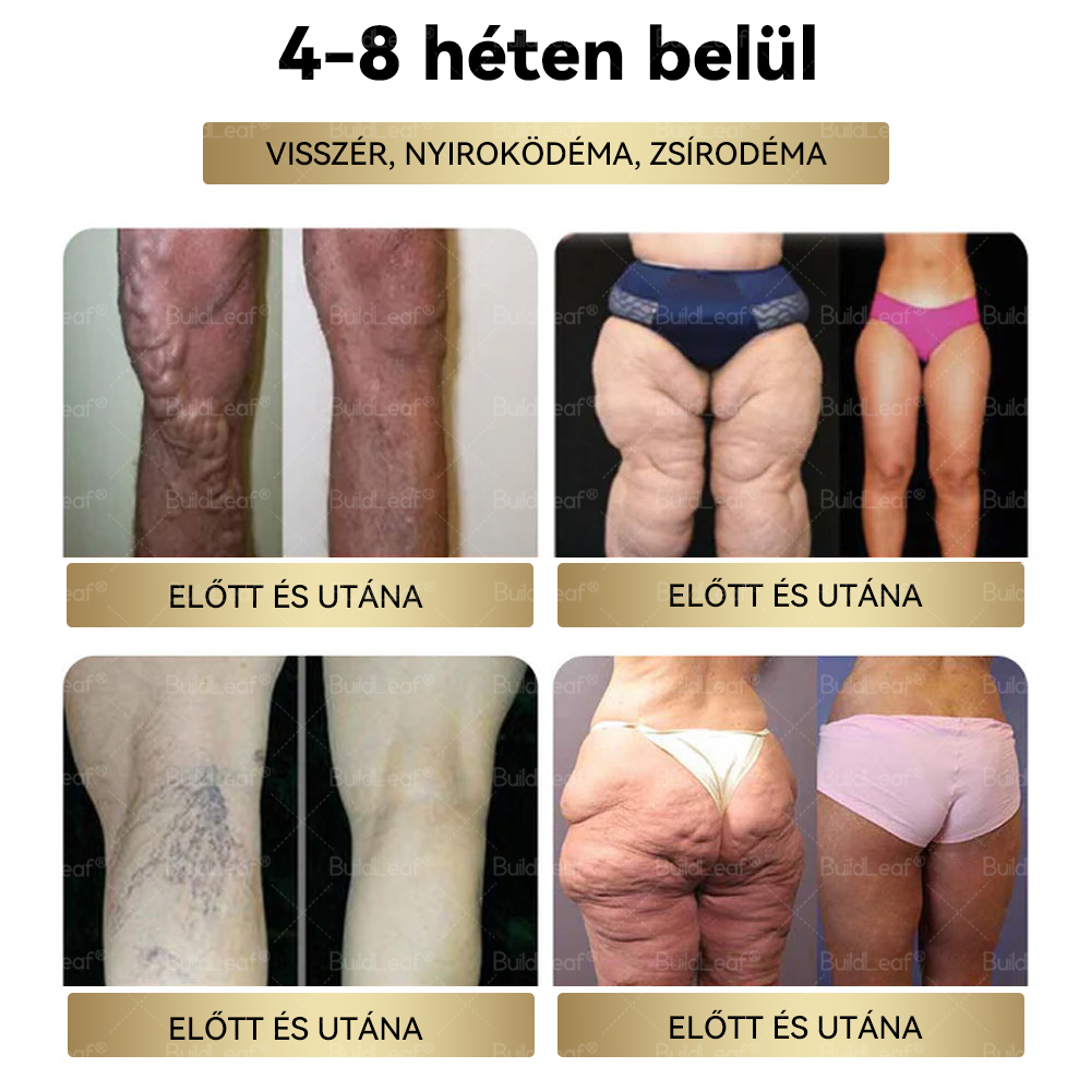 ⭐A Mayo Clinic által ajánlott | Hivatalos üzlet | BuildLeaf® GLP-1 Moringa Fogyókúrás és Egészségfokozó cseppek 🔥 (Élelmiszer-minőségű zsírégető – Az Obesity Society fejlesztése)