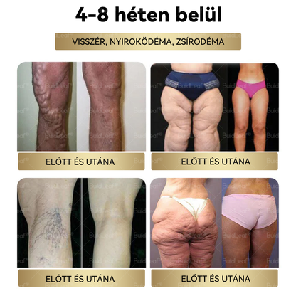 ⭐A Mayo Clinic által ajánlott | Hivatalos üzlet | BuildLeaf® GLP-1 Moringa Fogyókúrás és Egészségfokozó cseppek 🔥 (Élelmiszer-minőségű zsírégető – Az Obesity Society fejlesztése)