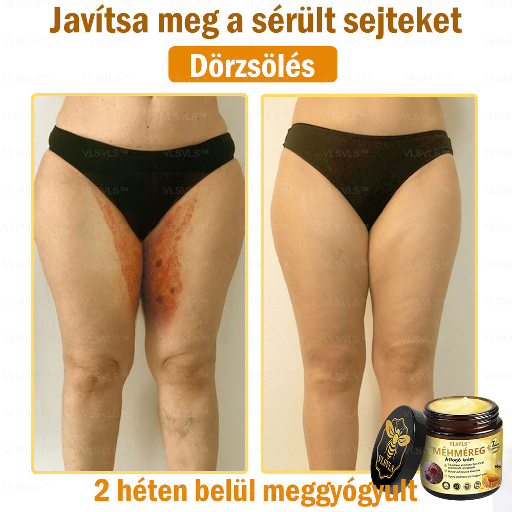 VLSVLS™ Méhméreg Átfogó Krém 🧑‍⚕️ Bőrgyógyászok Által Ajánlott - Különféle bőrproblémák kezelésére 50g