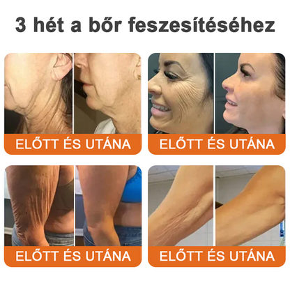 Az USA-ból készült és szállított ✨TLOPA® AH-8 Öregedésgátló Feszesítő Krém (🔥 UTOLSÓ NAP 70% KEDVEZMÉNY)