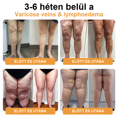 JOSFIT™ ultrahangos zsírfúvás és távoli infravörös vércukorszint-kiegyenlítő méregtelenítő csuklópánt - Energy Balance 🔥 Korlátozott idejű akció 🔥