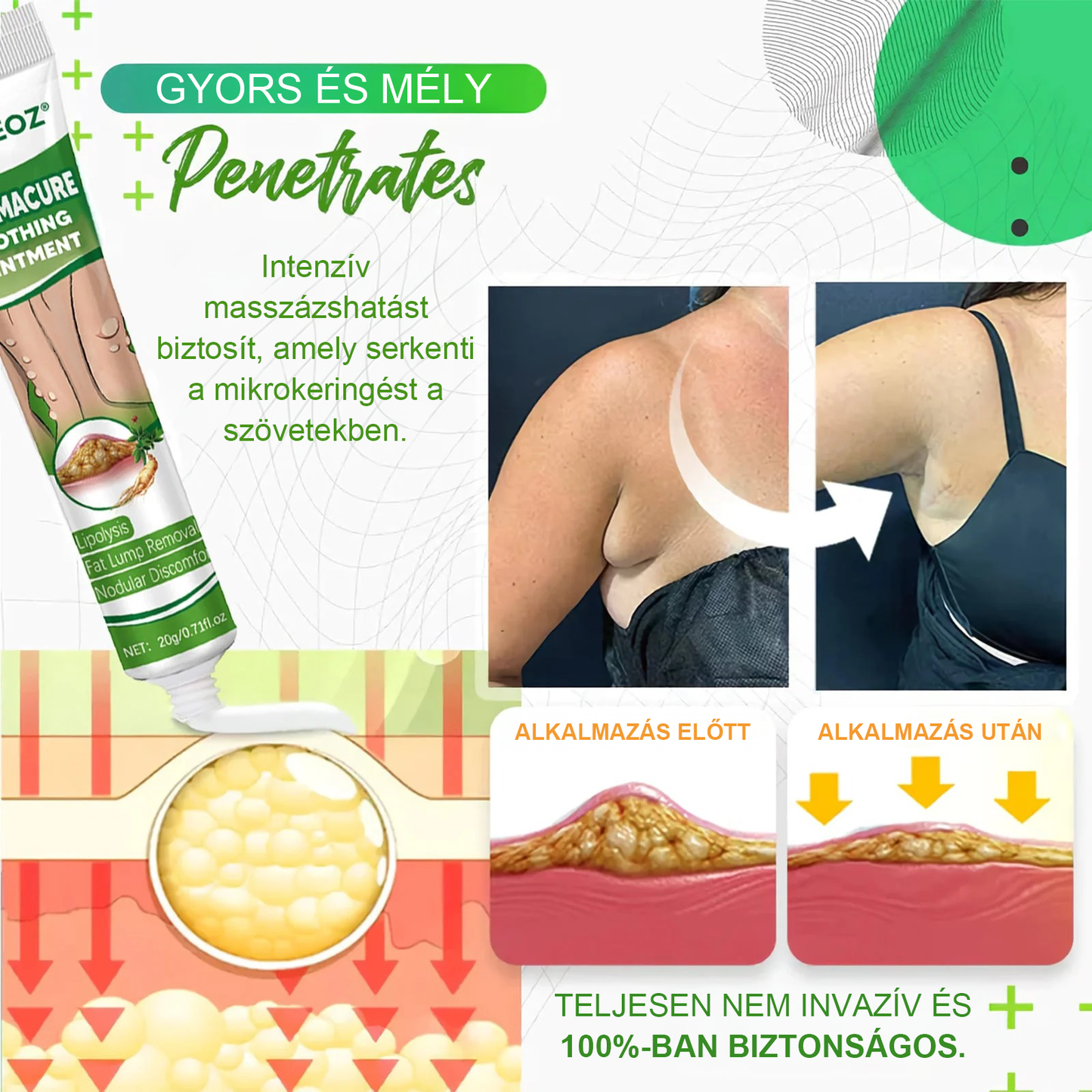 Cvreoz® Lipoma Cure nyugtató kenőcs