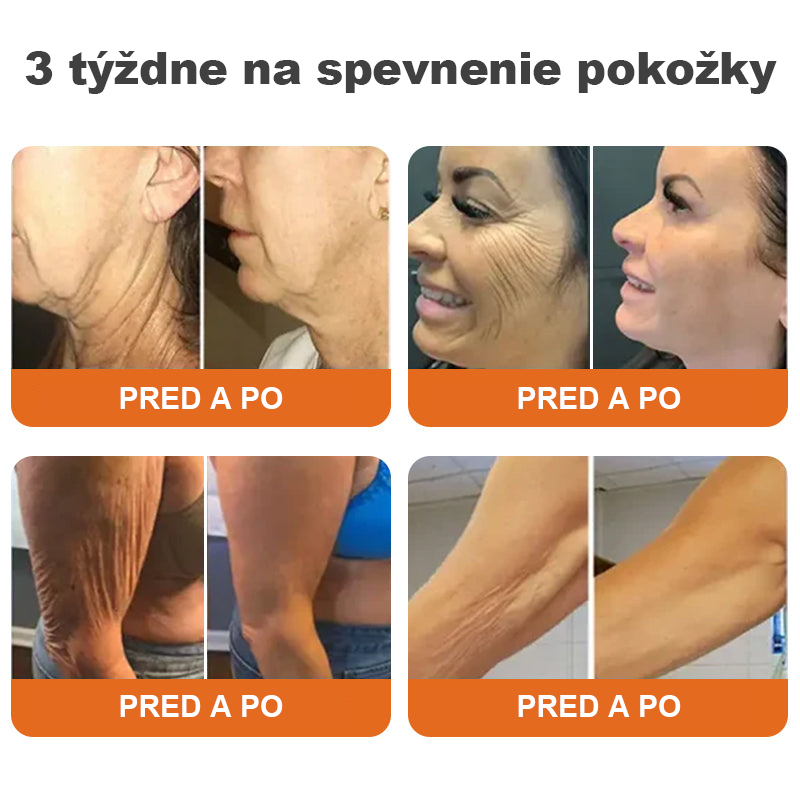 Vyrobené a dodané z USA ✨TLOPA® AH-8 Spevňujúci krém proti starnutiu (🔥 POSLEDNÝ DEŇ ZĽAVA 70 %)