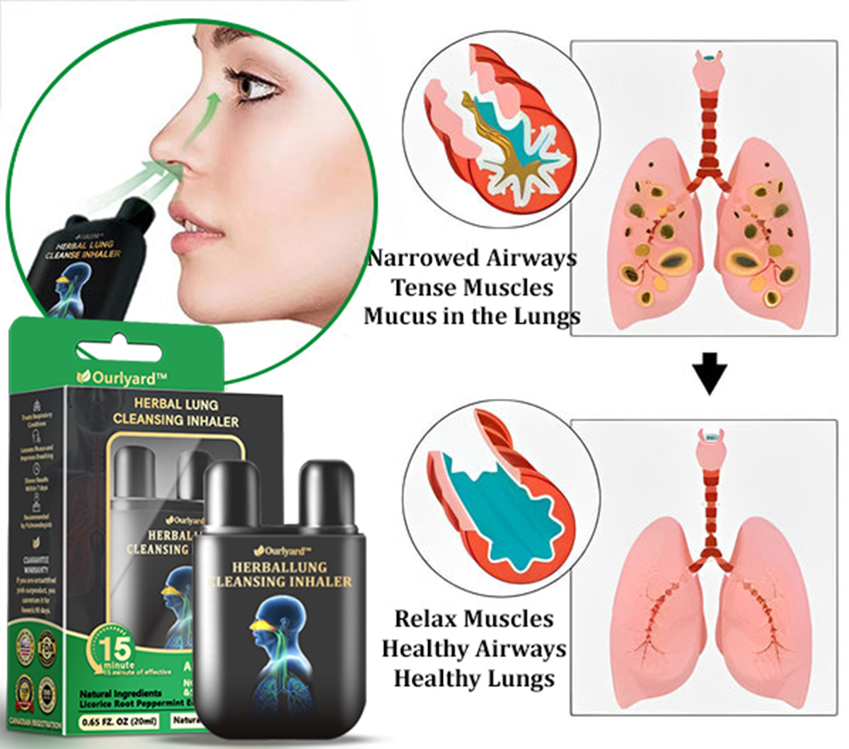✅Hivatalos üzlet: Ourlyard™ gyógynövényes tüdőtisztító inhalátor👨‍⚕️FDA-tanúsítvány (💝 Köhögés, sípoló légzés, légszomj, köpet, orrdugulás, hörghurut, hörghurut, allergiás tünetek, tüdő kellemetlen érzés💝)