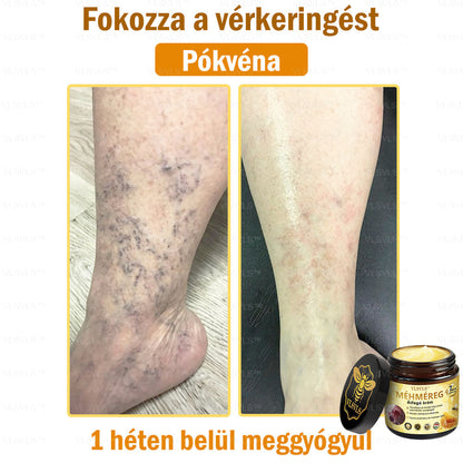 VLSVLS™ Méhméreg Átfogó Krém 🧑‍⚕️ Bőrgyógyászok Által Ajánlott - Különféle bőrproblémák kezelésére 50g