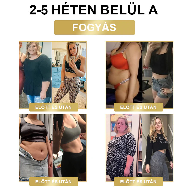 🥑 𝐉𝐎𝐒𝐅𝑰𝐓™ Ultrahangos csuklópántok a zsír eltávolítására és méregtelenítésére
