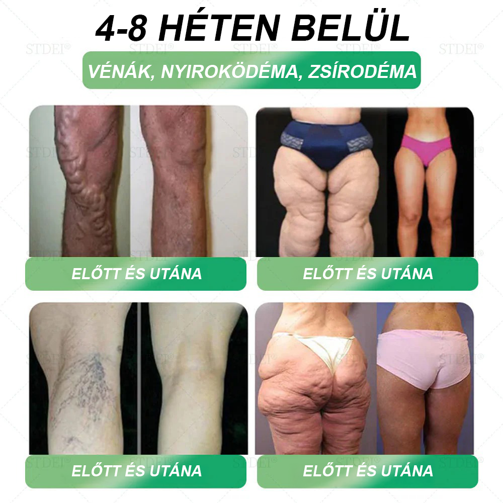 Mayo Klinika ajánlásával | Hivatalos áruház 👨‍⚕️STDEI® GLP-1 Fogyókúrás orális oldat 💥Elhízás, szív- és érrendszeri betegségek, cukorbetegség, alvási apnoe, ízületi problémák stb.