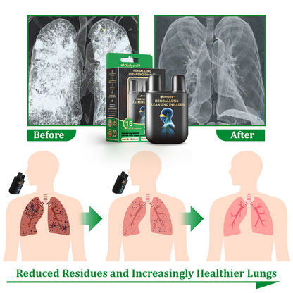 ✅Hivatalos üzlet: Ourlyard™ gyógynövényes tüdőtisztító inhalátor👨‍⚕️FDA-tanúsítvány (💝 Köhögés, sípoló légzés, légszomj, köpet, orrdugulás, hörghurut, hörghurut, allergiás tünetek, tüdő kellemetlen érzés💝)
