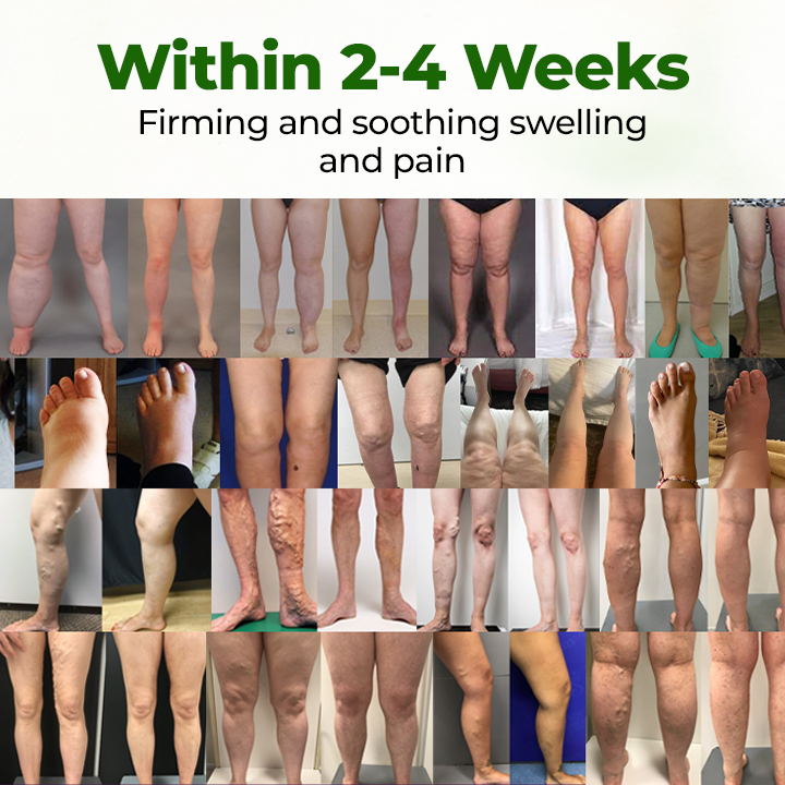 Timilk® Professional lábkeringést serkentő krém