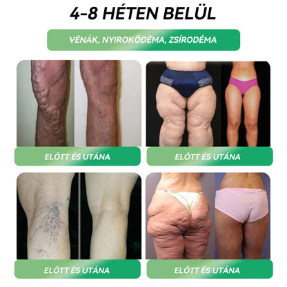 Semmelweis Egyetemi Kórház Ajánlásai |hivatalos áruház |💗 𝐒𝐓𝐃𝐄𝐈® 𝐆𝐋𝐏-𝟏 𝐅𝐨𝐠𝐲á𝐬 𝐒𝐳á𝐣𝐨𝐧 á𝐭 𝐚𝐥𝐤𝐚𝐥𝐦𝐚𝐳𝐡𝐚𝐭ó 𝐨𝐥𝐝𝐚𝐭 - 👨‍⚕️ Elhízás, szív- és érrendszeri betegségek, cukorbetegség, alvási apnoe, ízületi problémák és egyebek